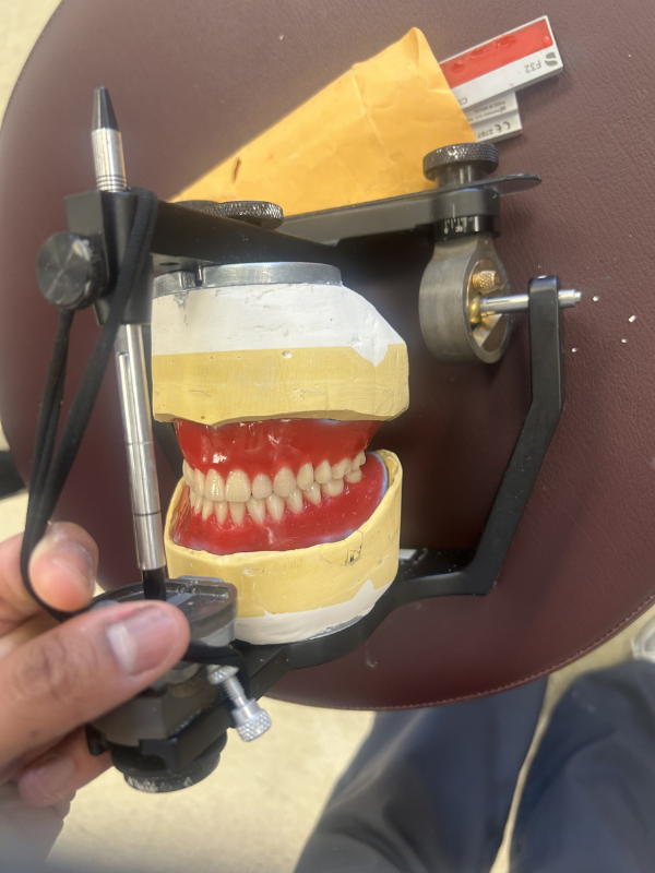 Dental articulator with mounted model